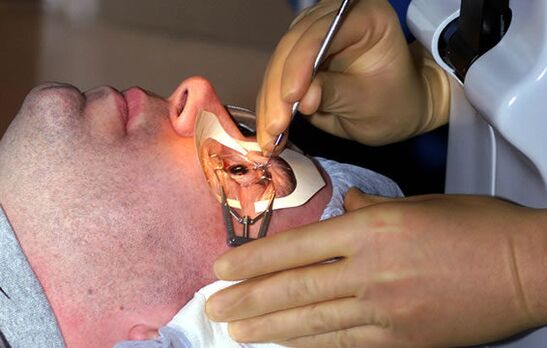 Склеропластика за миопия за стабилизиране на зрението